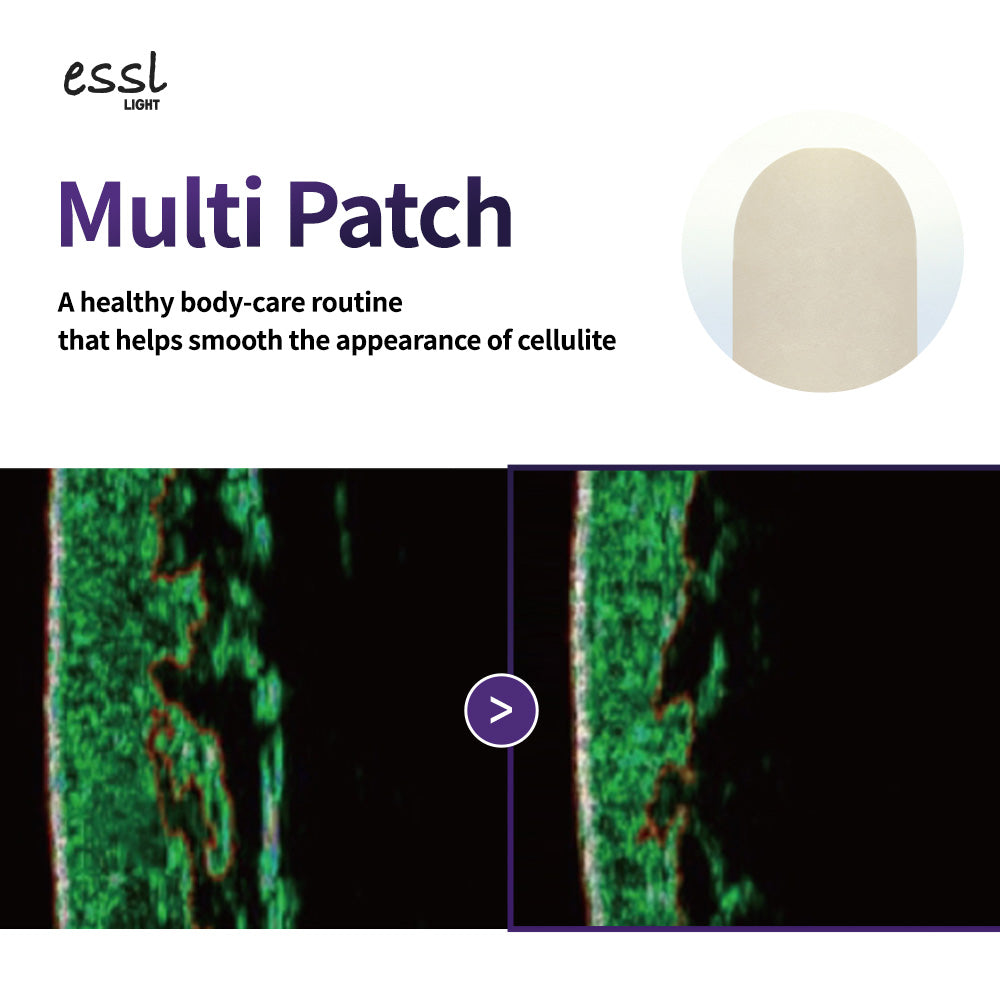 Multi Patch