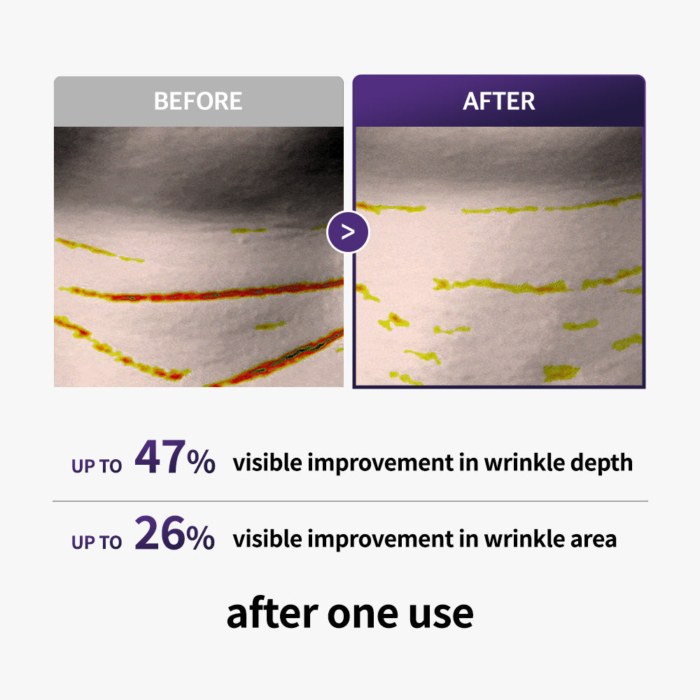 Retinal Age-Reset Neck Patch