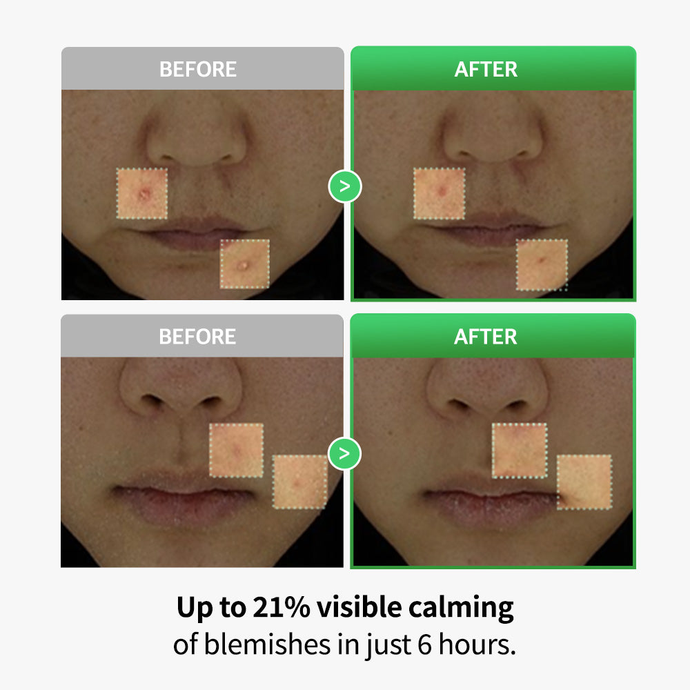 Cica Lactobacillus Spot Control Shot