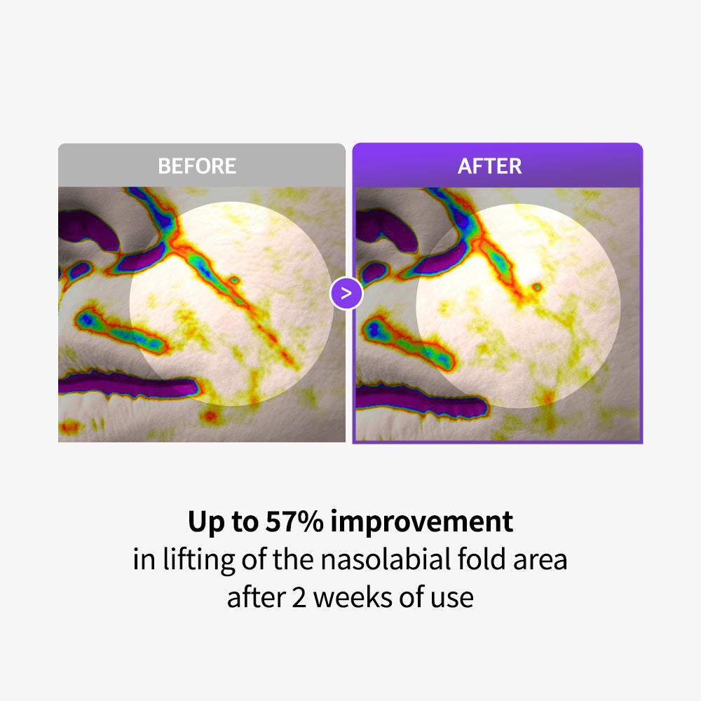 PLLA Age-Reset Wrinkle Cream Plus