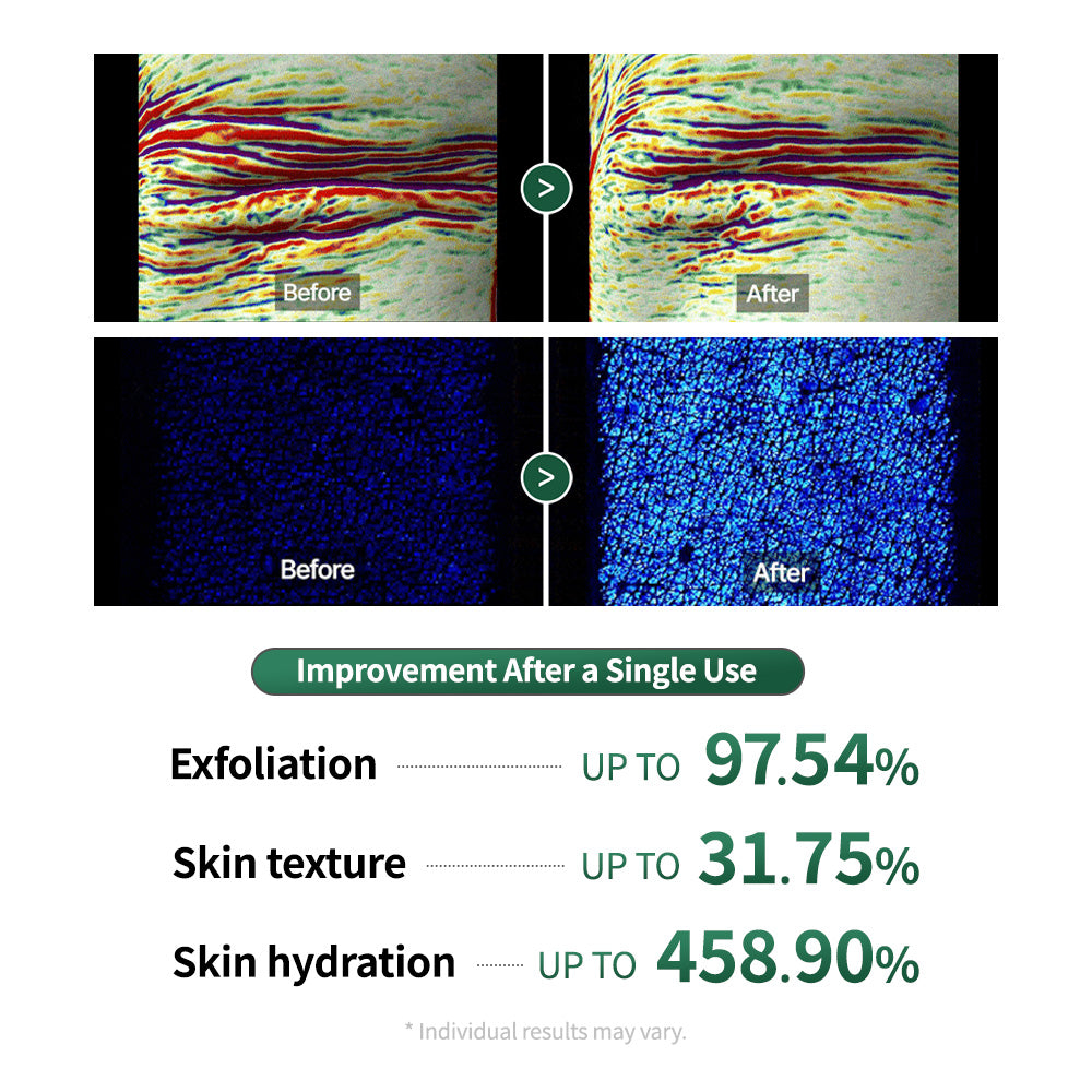 Heartleaf Peelief Clear Gel