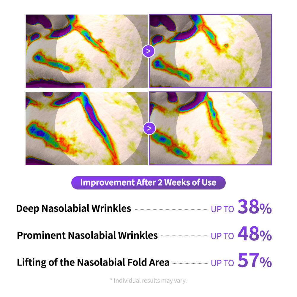 PLLA Age-Reset Wrinkle Cream Plus