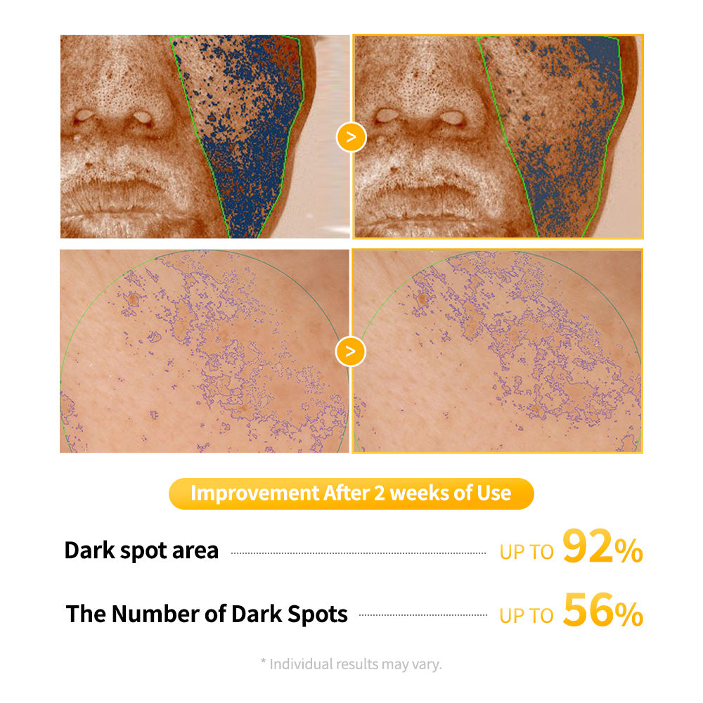 Arvitathion Brithoning Cream & Patch Duo