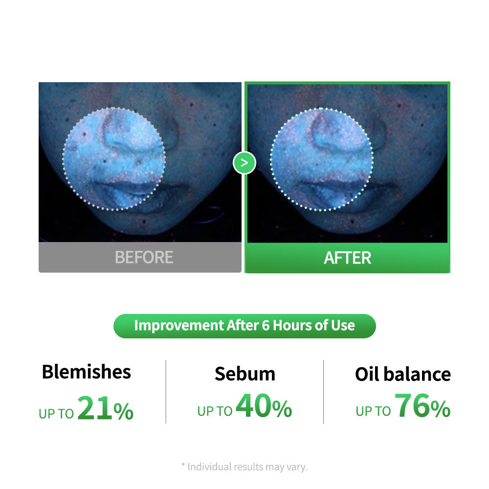 Cica Lactobacillus Spot Control Shot