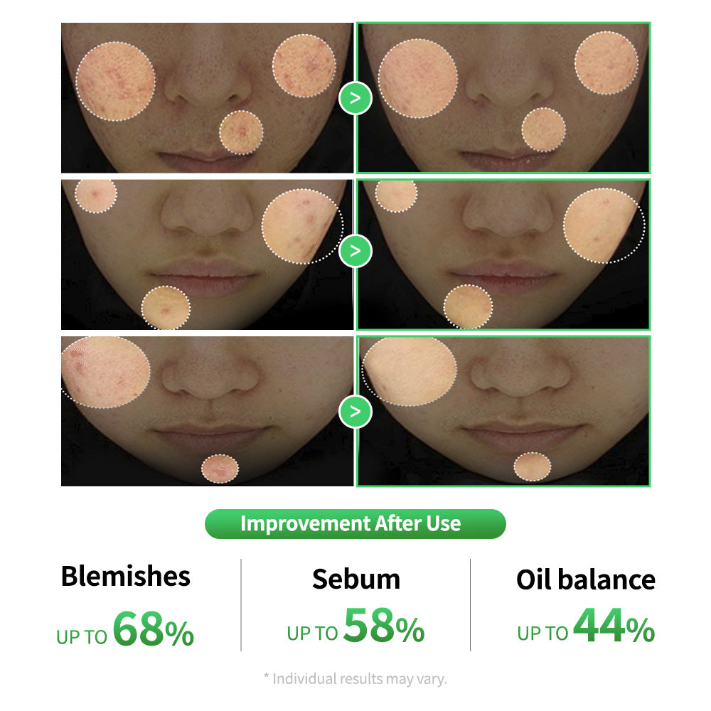 Cica Lactobacillus Spot Control Patch