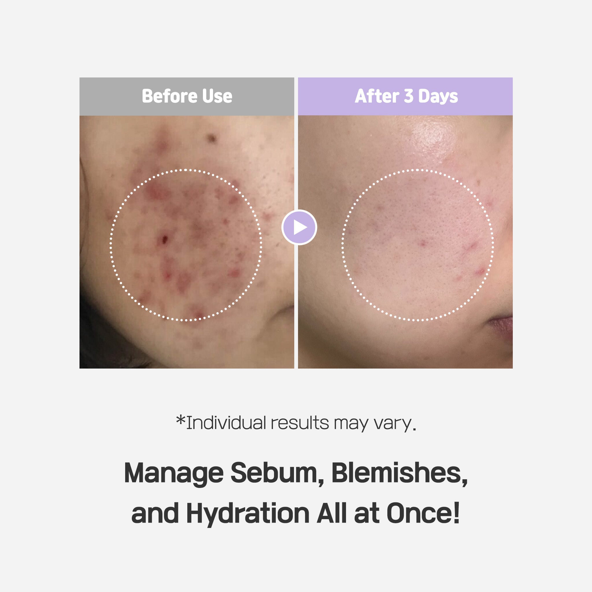 Azulene Spot Control Quota Pad