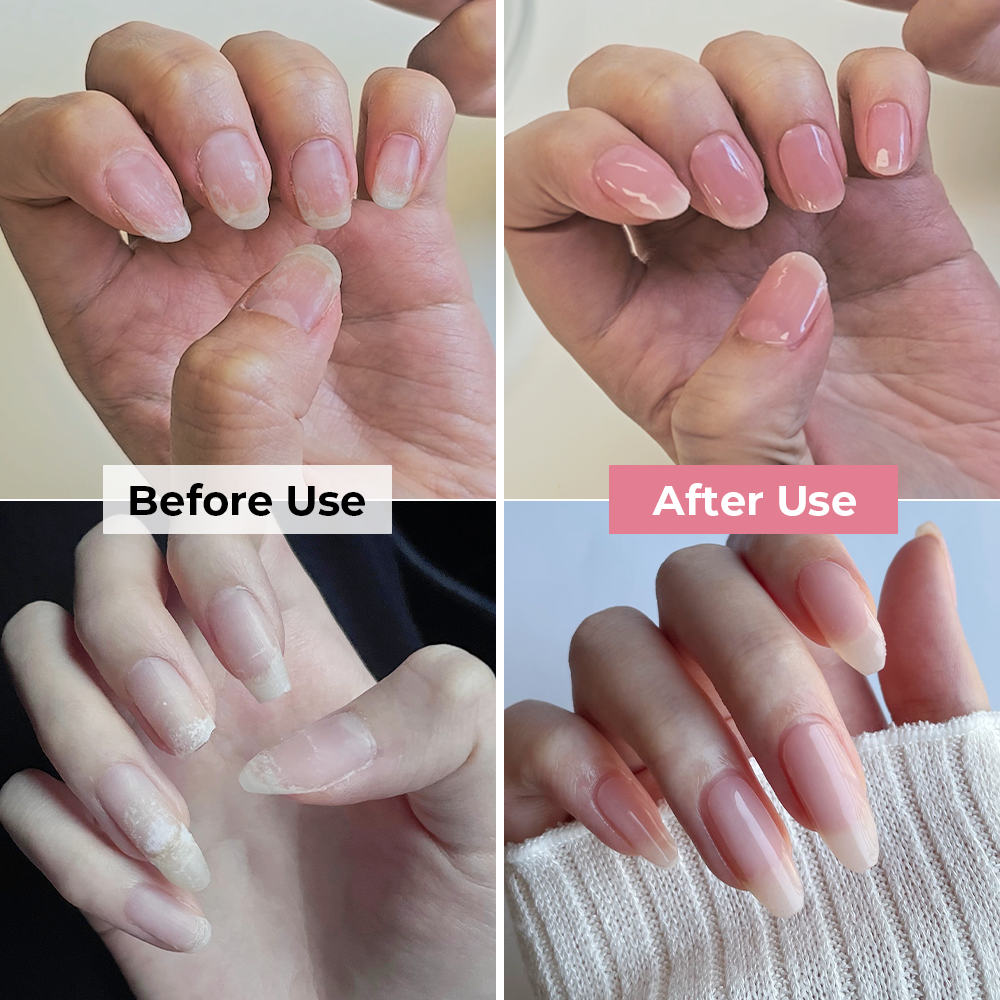 Keratin Defense Nail Patch