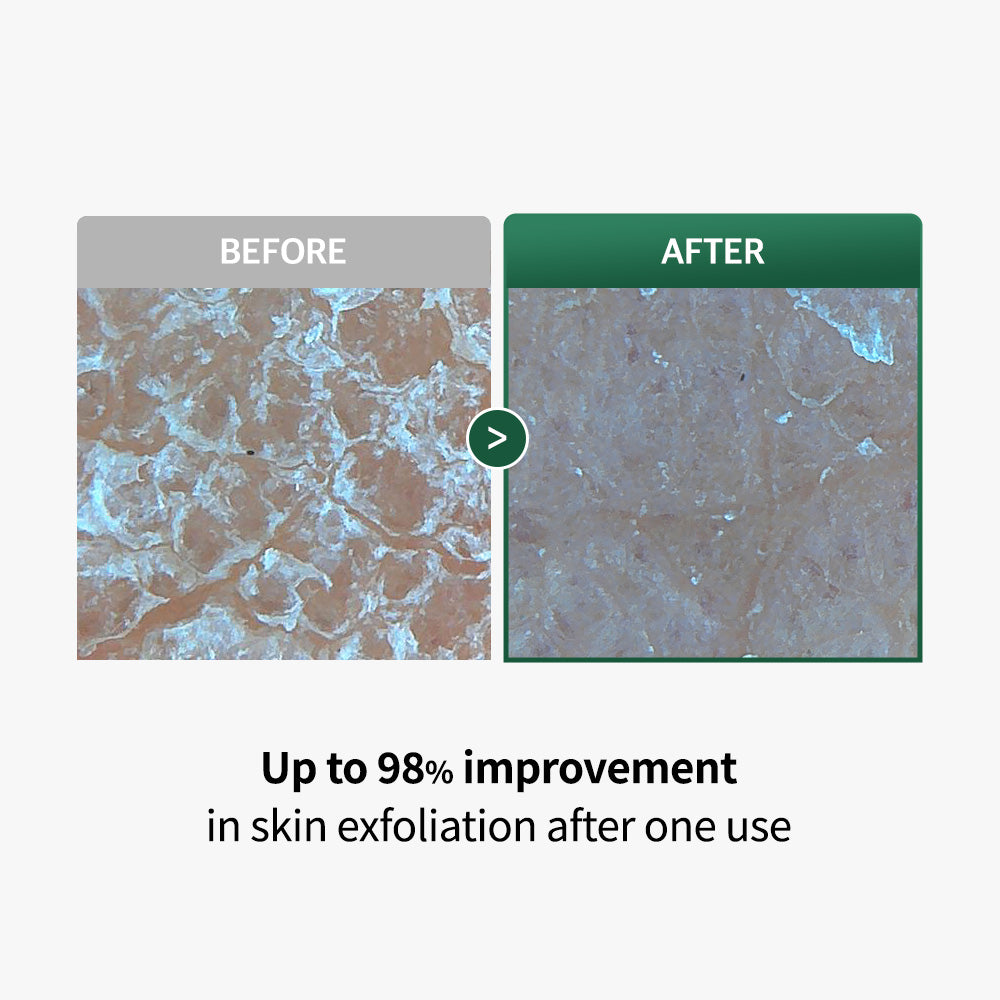 Heartleaf Peelief Foot Patch