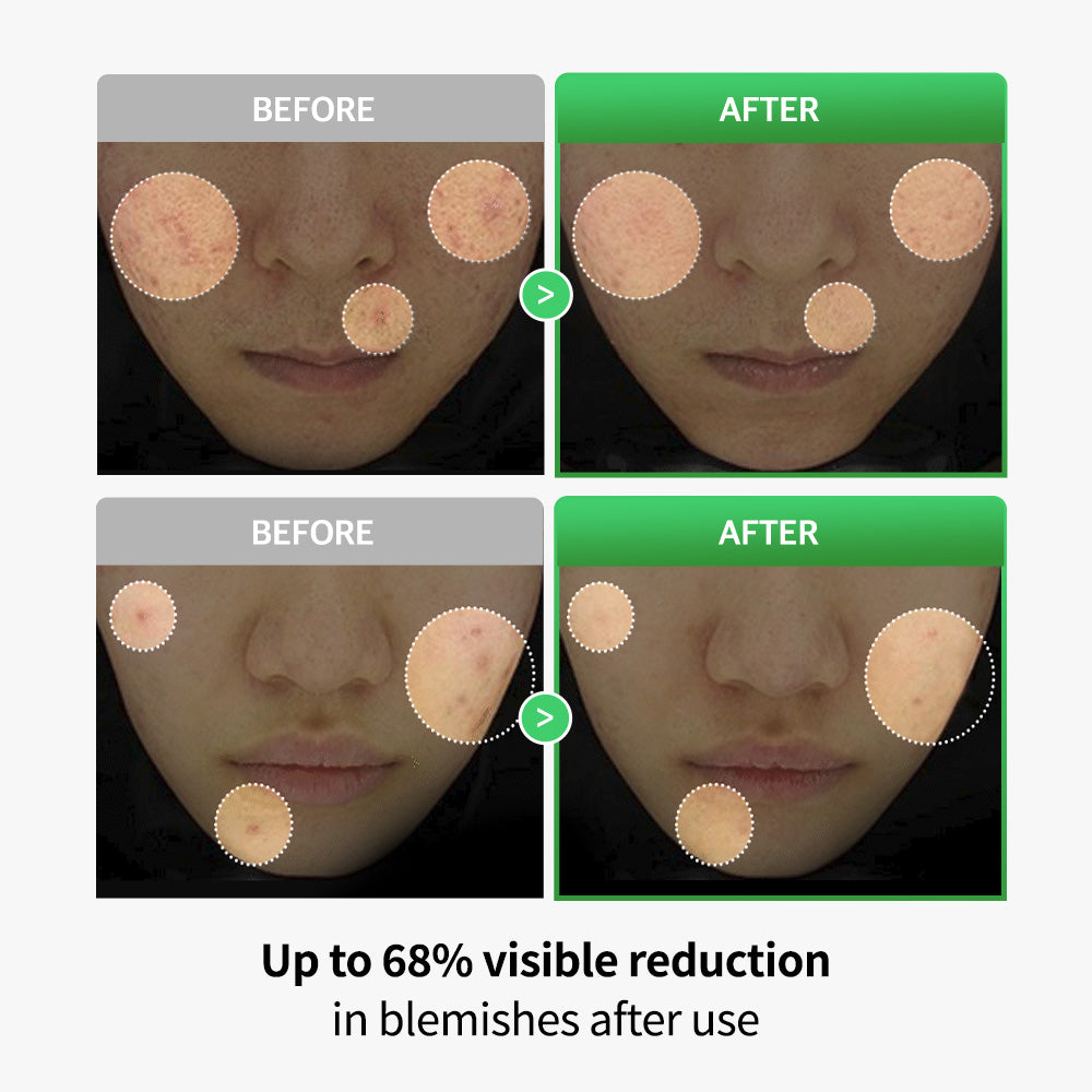 Cica Lactobacillus Spot Control Patch