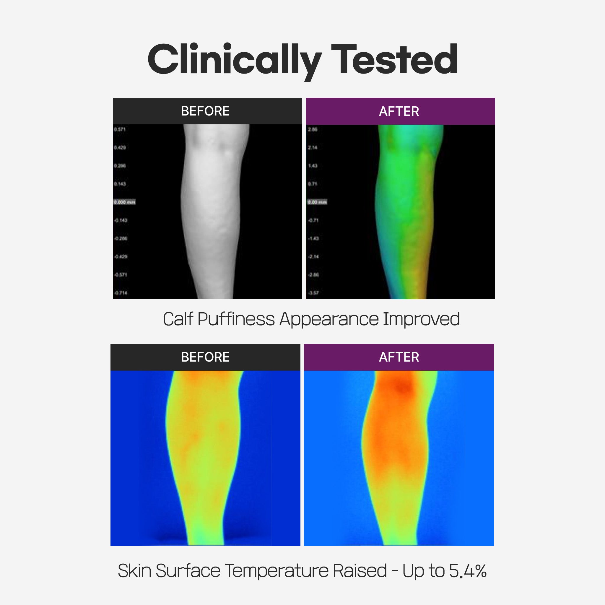 Calf Patch (SLLIGHT Version)
